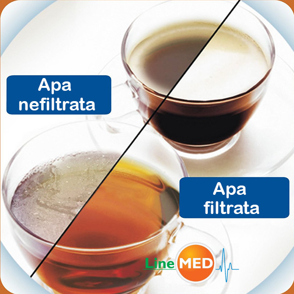 apa-filtrata-nefiltrata.jpg